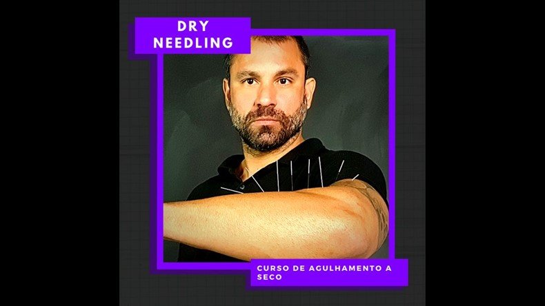 Aprenda Dry Needling Funciona? Aprenda Dry Needling Vale a Pena mesmo?